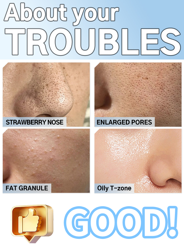 Blackhead Remover Pore Cleaner - Pore Vacuum ulasan dan harga