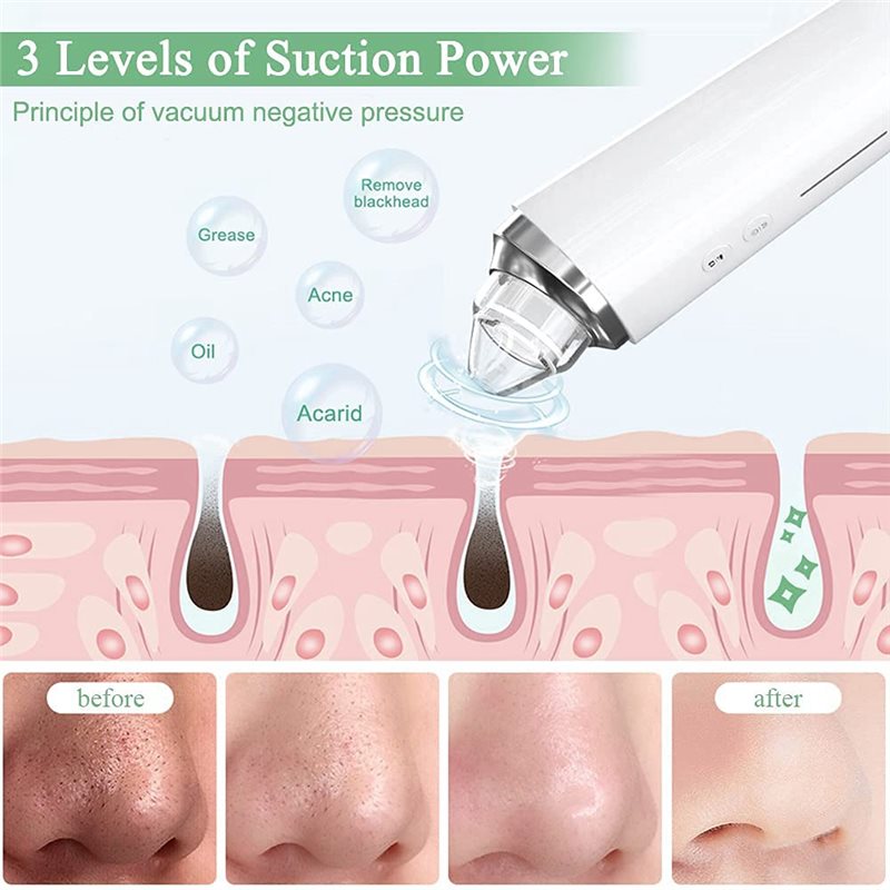 【FITTING】Blackhead Remover Por - Pore Vacuum ulasan dan harga