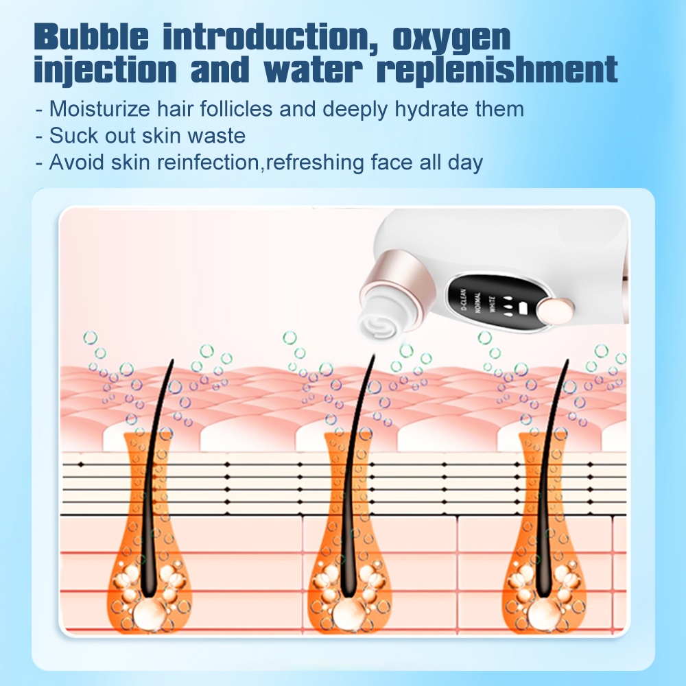 Electric Blackhead Remover Por - Pore Vacuum ulasan dan harga
