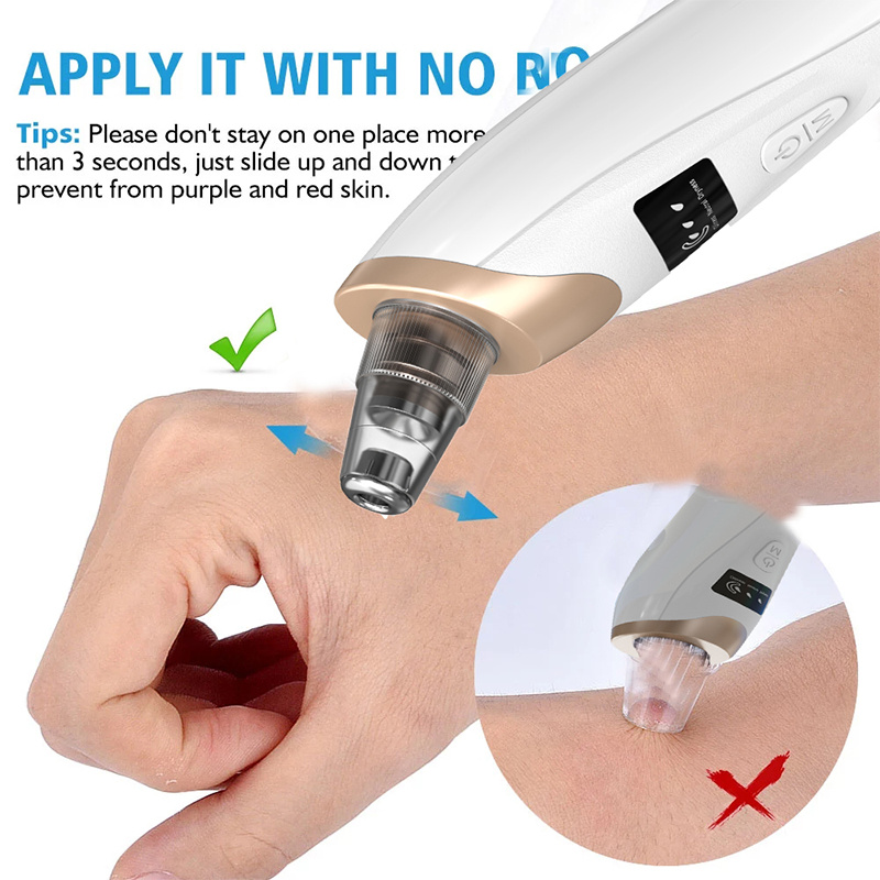 Blackhead Remover Pimples and  - Pore Vacuum ulasan dan harga